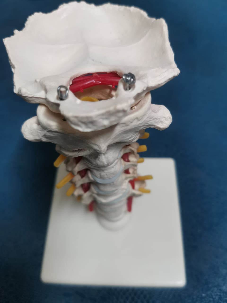 SPINAL CORD ON STAND